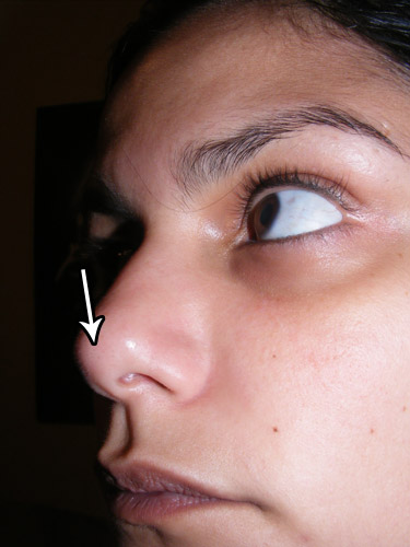 Resenha: Purederm Deep Cleansing Nose Strip