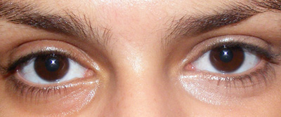 Tutorial em vídeo: Tchau tchau, olheiras!