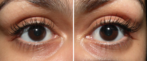 hypnose71