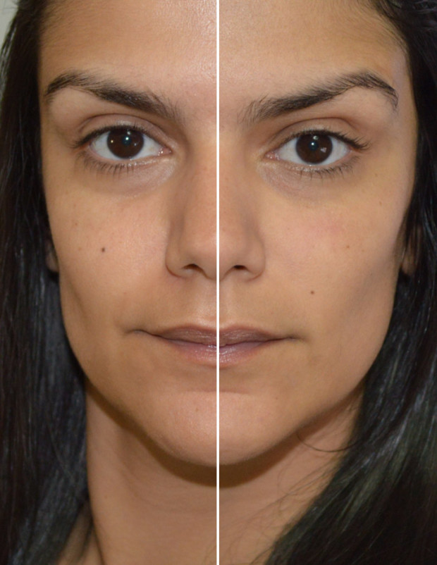 Produtos e Cuidados com a Pele: L’Oréal Revitalift Blur Mágico