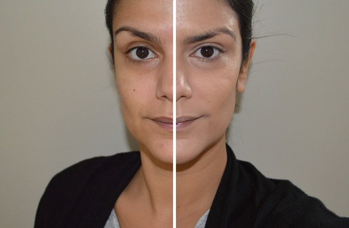clinique11